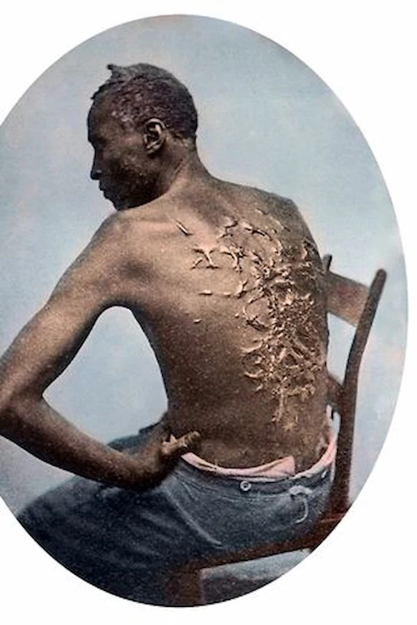 photo of Peter's lacerated back became one of the most widely circulated images of slavery Image Images by HistoryUniversal Images Group via Getty Images